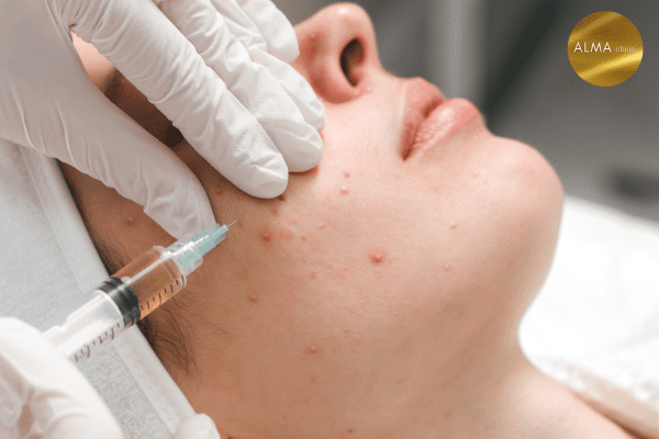 dieu tri seo seo ro seo loi seo xau sau phau thuat 2 Phòng khám da liễu ALMA CLINIC dieu tri seo seo ro seo loi seo xau sau phau thuat 2