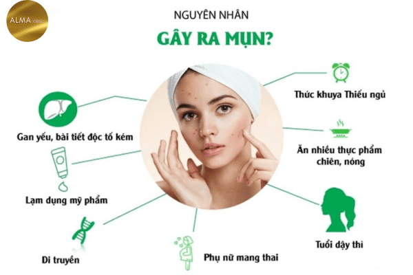 Phòng khám da liễu ALMA CLINIC 5 dieu can biet ve mun trung ca 2