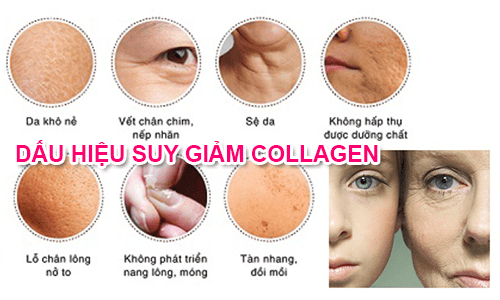Thiếu Hụt Collagen Liên Quan Như Thế Nào Đến Sự Lão Hóa