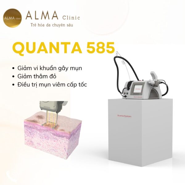 Laser Quanta 585 trị mụn