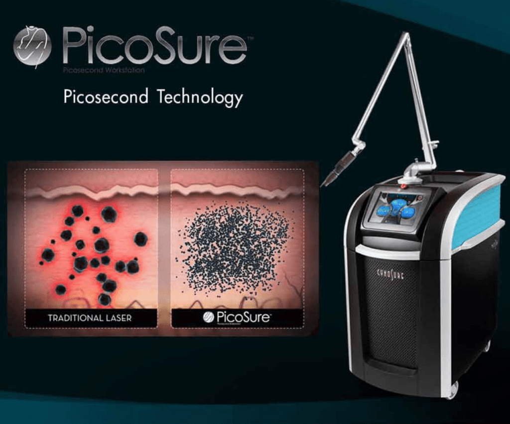 pico CÔNG NGHỆ LASER PICOSURE LÀ GÌ? ƯU VÀ NHƯỢC ĐIỂM? 7 ĐIỀU CẦN LƯU Ý KHI ĐIỀU TRỊ