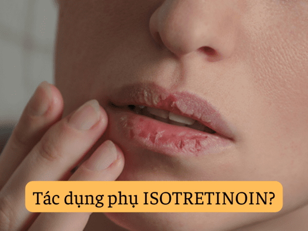 ISOTRETINOIN 10mg 20mg là thuốc gì? Ưu điểm và tác dụng phụ khi trị mụn