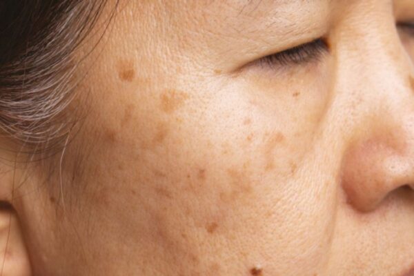 Phòng khám da liễu ALMA CLINIC doi moi