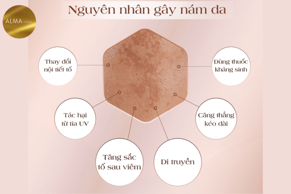 Phòng khám da liễu ALMA CLINIC nam hon hop nguyen nhan va cac cach dieu tri hieu qua 2