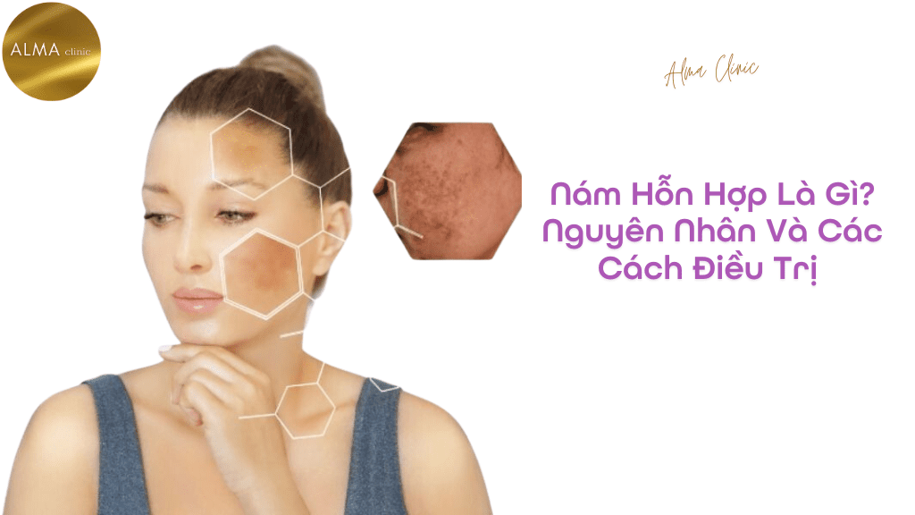 Phòng khám da liễu ALMA CLINIC nam hon hop nguyen nhan va cac cach dieu tri hieu qua