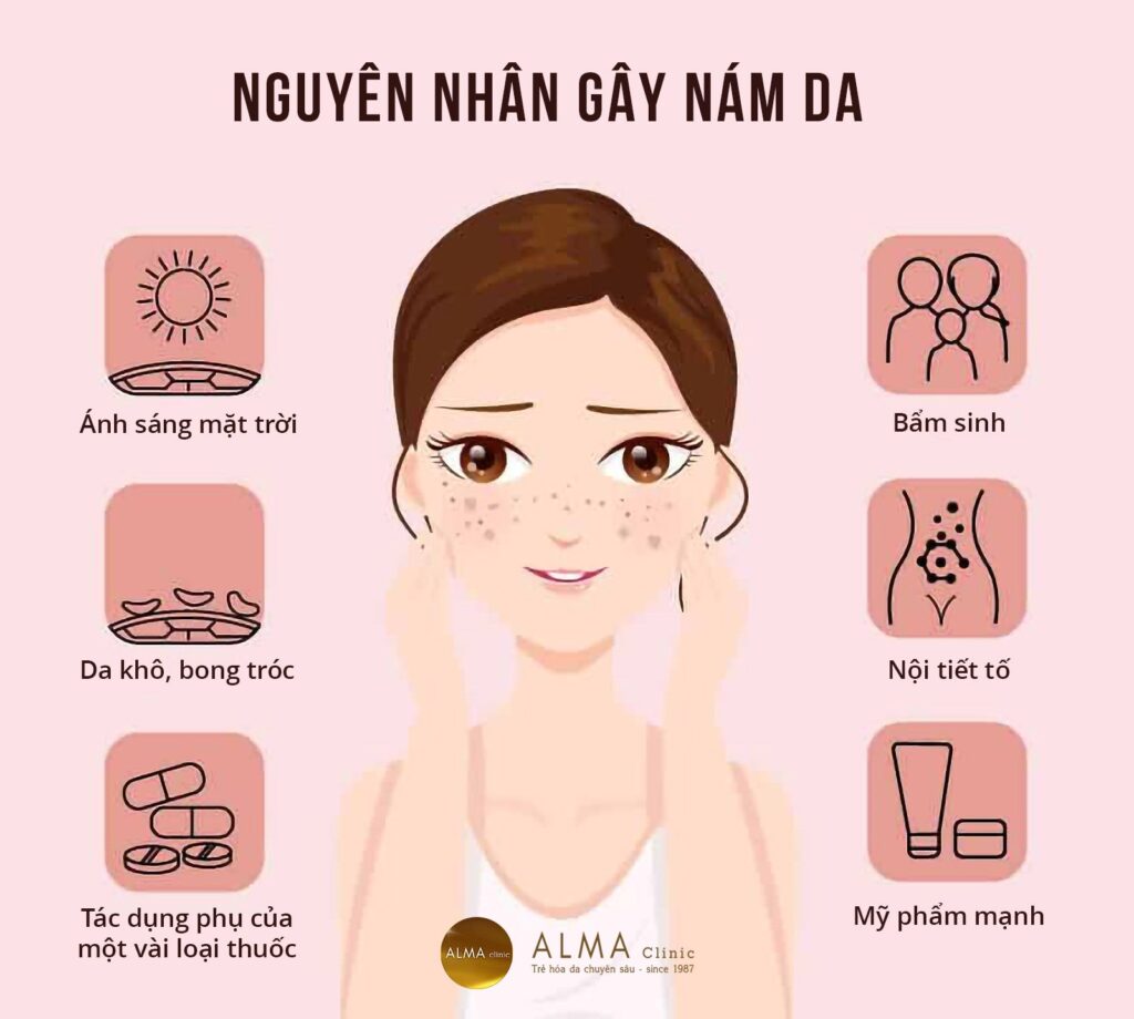 Nguyên nhân gây nám da