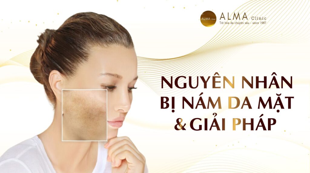 Nguyên nhân bị nám da mặt và giải pháp_thumbnail