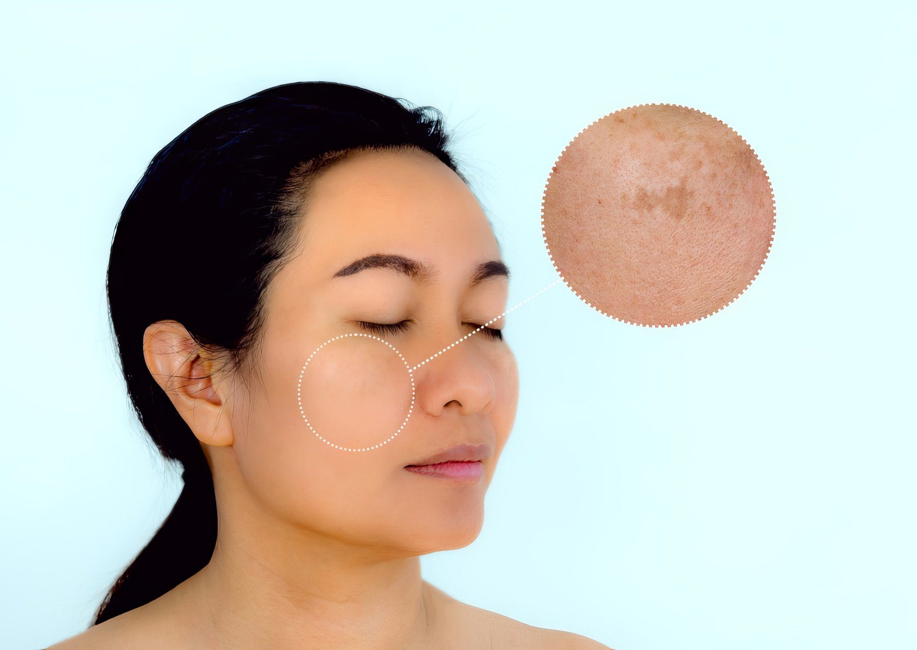 Nguyen Nhan Nam Da Dang Sau Nhung Mang Sac To La Cau Chuyen Cua Lan Da 3 Di truyền cũng là một nguyên nhân nám da ít được để ý