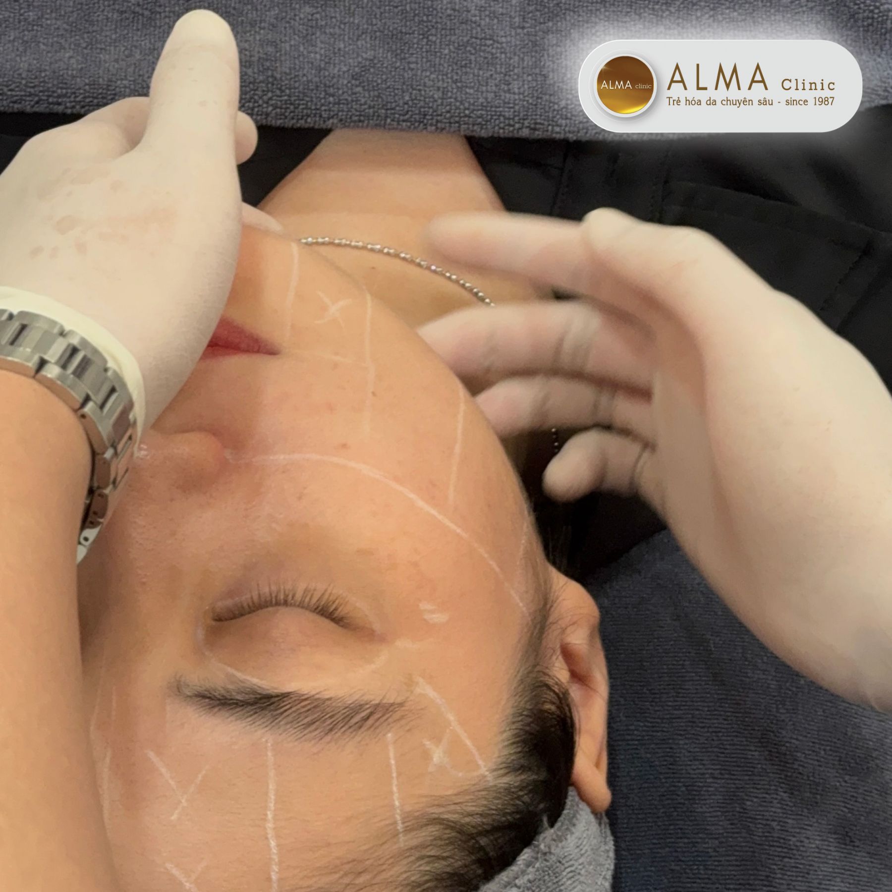 Cá nhân hóa liệu trình điều trị phù hợp với từng tình trạng da