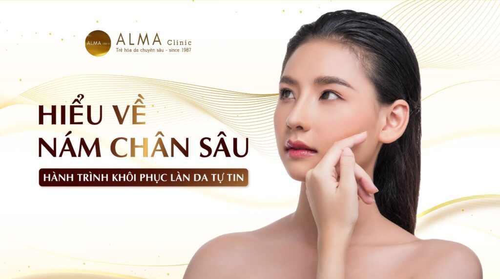 Hiểu về nám chân sâu và hành trình khôi phục làn da tự tin_thumbnail