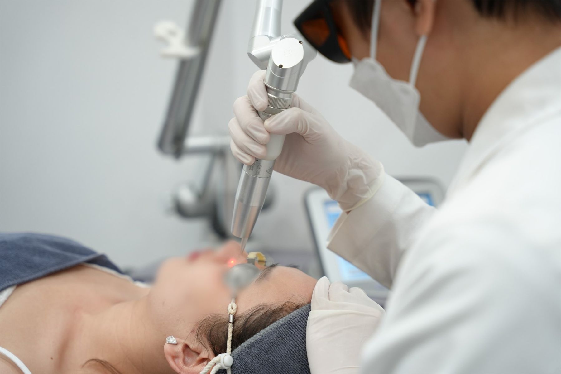 Phương pháp điều trị nám mảng nội tiết - Sử dụng laser chuyên sâu