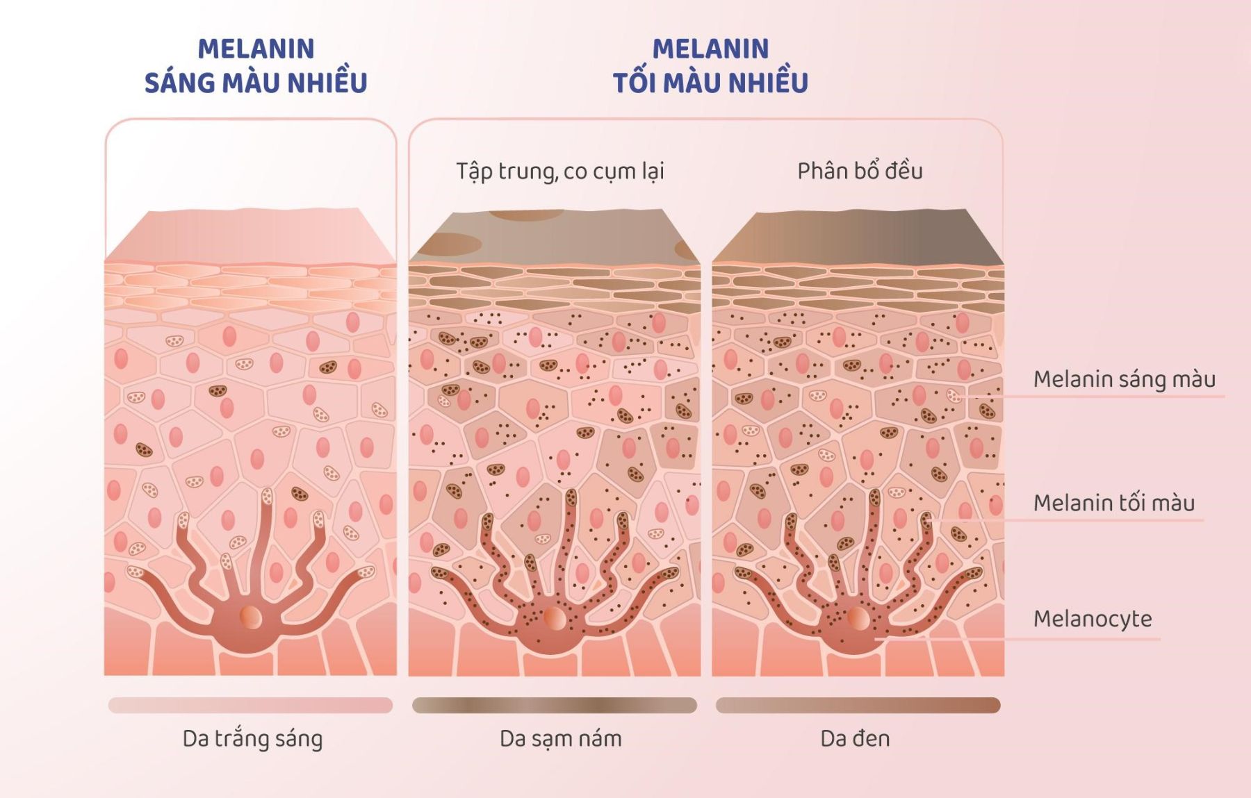 Phân loại nám: Thấu hiểu “kẻ thù” để giành lại làn da sáng mịn