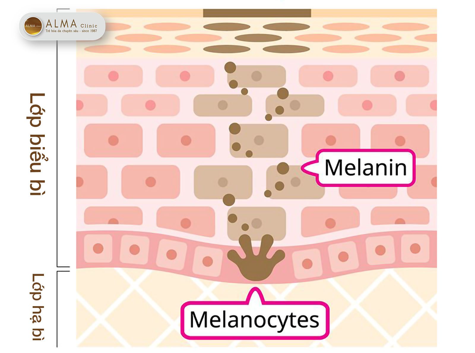 Nám da - Kẻ thù cứng đầu cần giải pháp khoa học