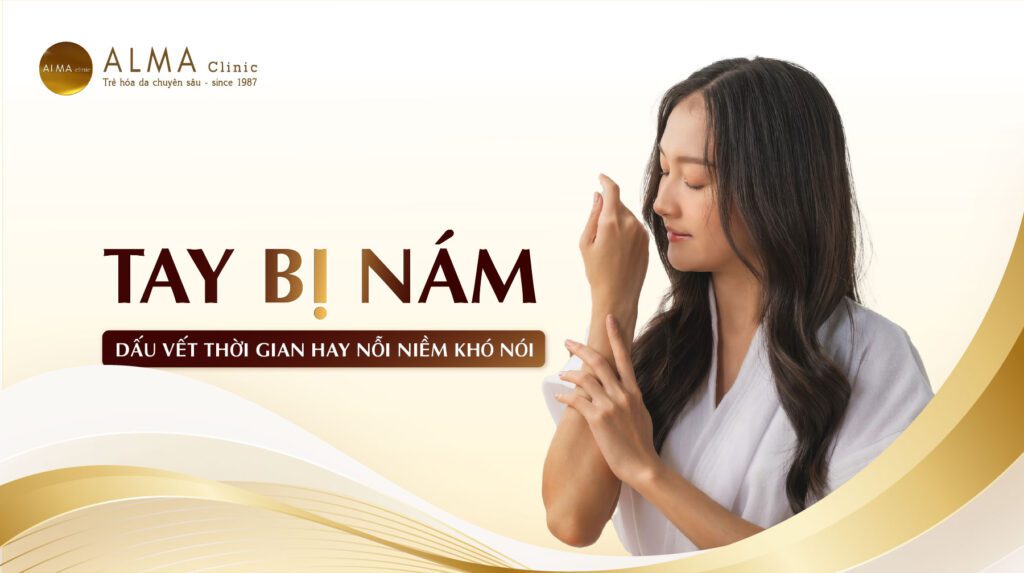 Tay bị nám: "Dấu vết thời gian" hay nỗi niềm khó nói của phái đẹp_thumbnail-13