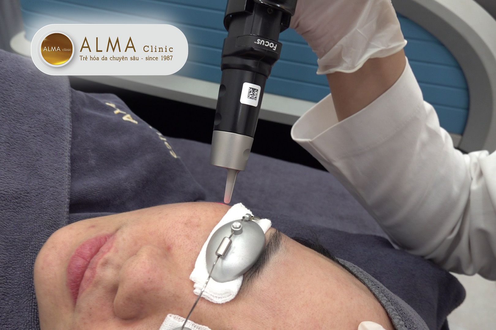 "Tiêu chí vàng" để lựa chọn spa trị nám uy tín