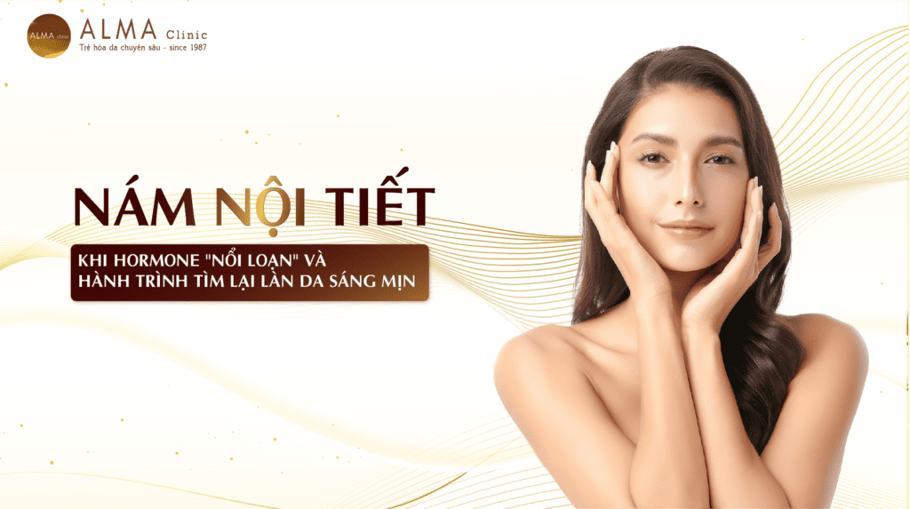 Nám nội tiết: Khi hormone nổi loạn và hành trình tìm lại làn da sáng mịn