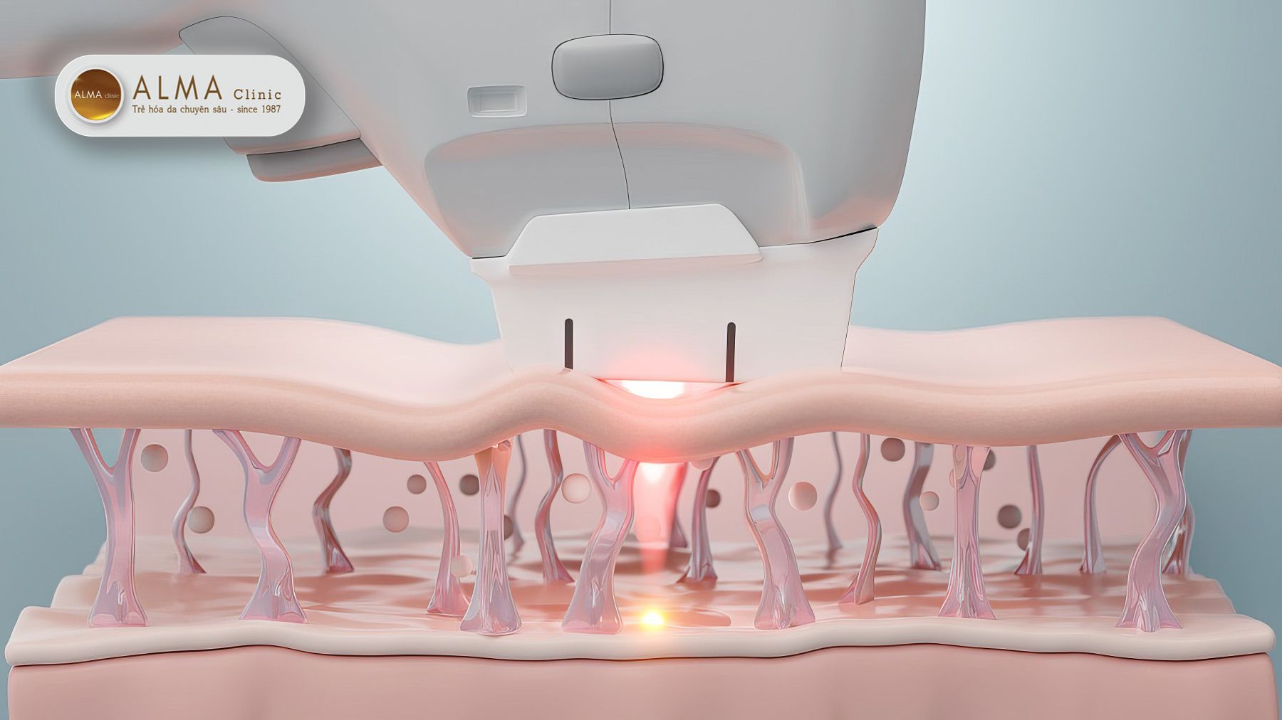 Nam o tay co dieu tri duoc khong Giai phap nao la toi uu Nám ở tay có điều trị được không? Giải pháp nào là tối ưu?