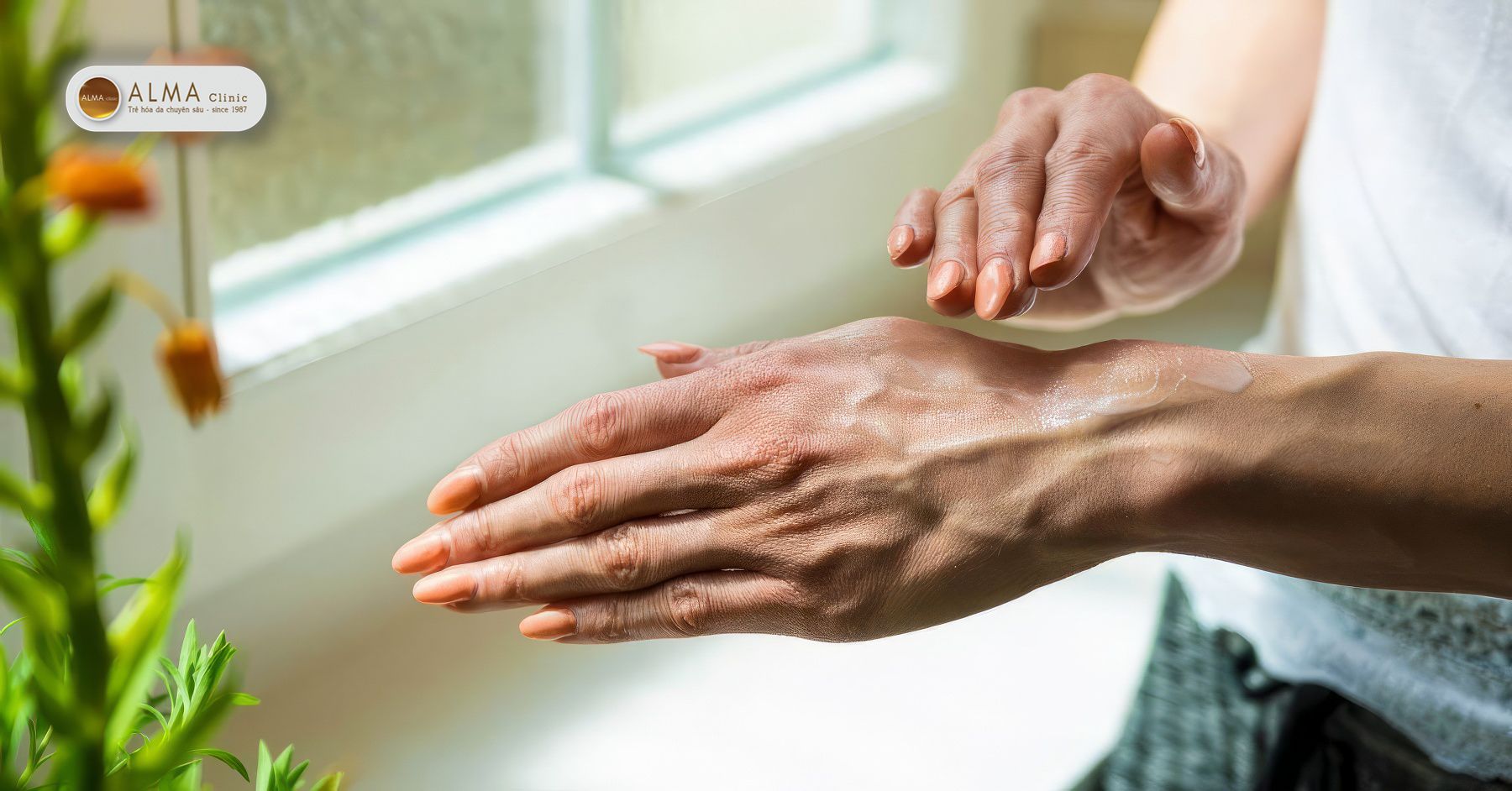 Nam da tay co tu het khong Cau tra loi khong don gian nhu nhieu nguoi van tuong Nám da tay có tự hết không? Câu trả lời không đơn giản như nhiều người vẫn tưởng