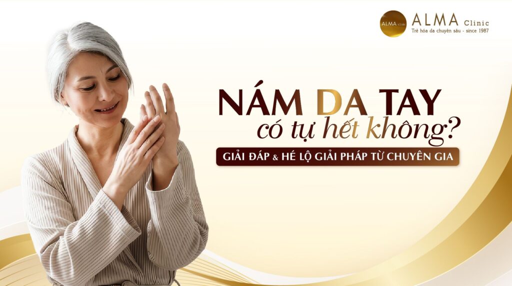 Nam da tay co tu het khong Chuyen gia da lieu giai dap va he lo giai phap toi uu Nám da tay có tự hết không? Chuyên gia da liễu giải đáp và hé lộ giải pháp tối ưu