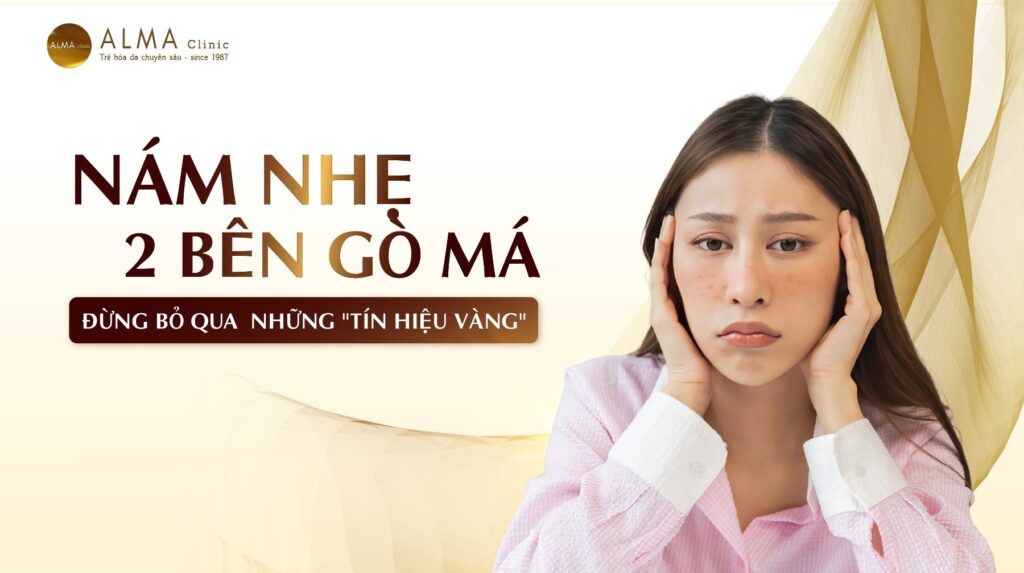 Nam nhe 2 ben go ma Dung bo qua tin hieu vang Can thiep som ngua nam lan Nám nhẹ 2 bên gò má: Đừng bỏ qua "tín hiệu vàng" - Can thiệp sớm, ngừa nám lan!