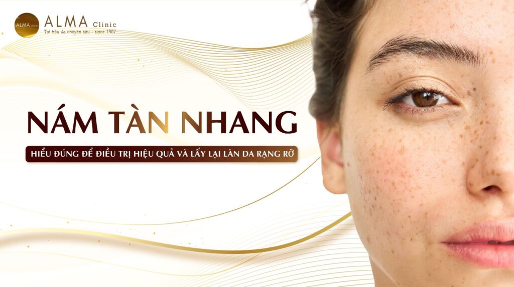 Nám tàn nhang – Nỗi lo âm thầm của phụ nữ