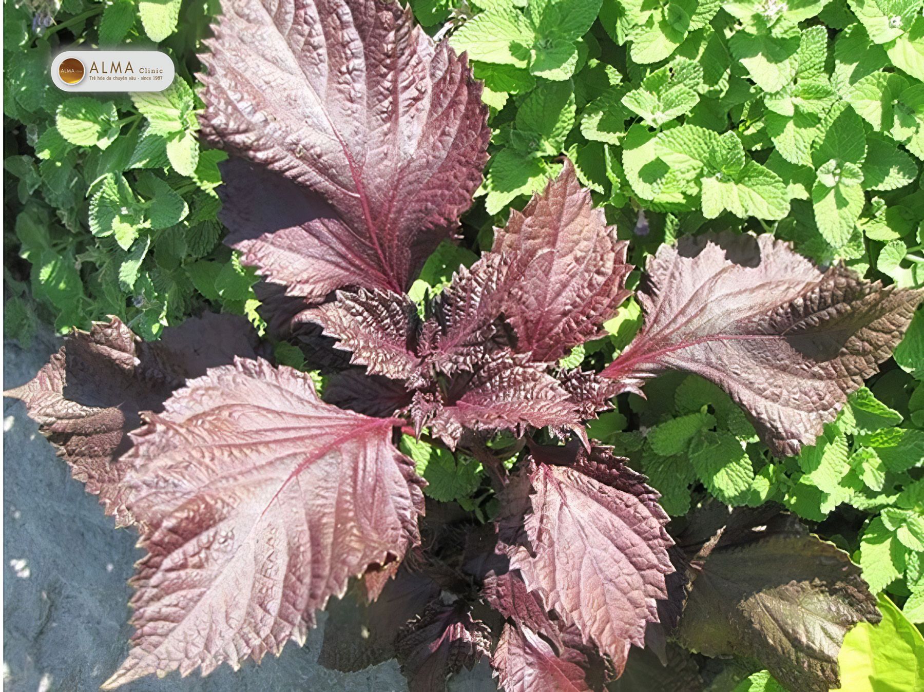 Tri nam bang tia to co thuc su hieu qua Trị nám bằng tía tô có thực sự hiệu quả?