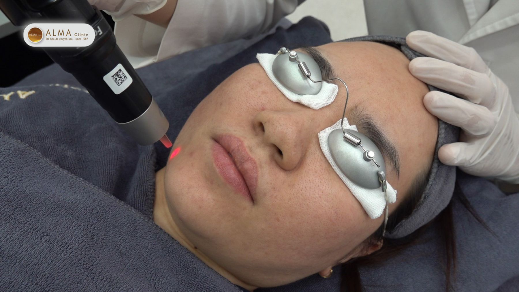 Từ kinh nghiệm dân gian đến giải pháp y khoa Con đường trị nám tàn nhang hiệu quả