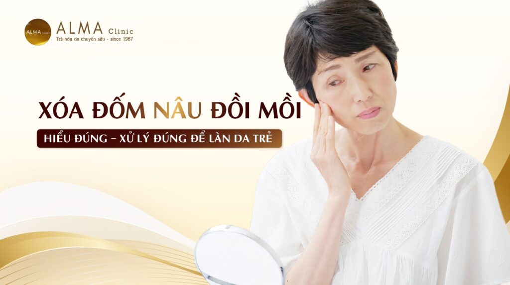 Xoa dom nau doi moi Hieu dung – Xu ly dung de lan da tre lai tung ngay Xóa đốm nâu đồi mồi: Hiểu đúng – Xử lý đúng để làn da trẻ lại từng ngày