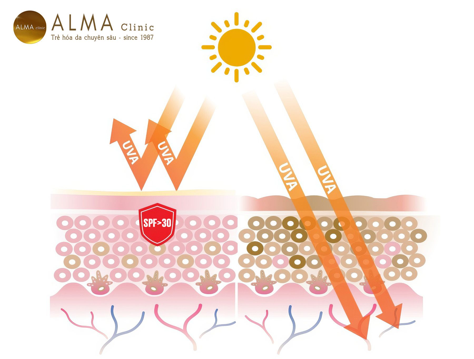 Xoa dom nau doi moi Vi sao cang lon tuoi cang xuat hien nhieu Xóa đốm nâu đồi mồi - Vì sao càng lớn tuổi càng xuất hiện nhiều?