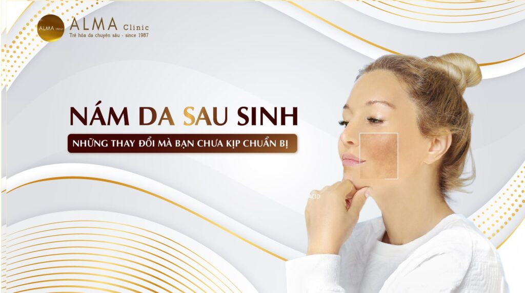 Nám da sau sinh và những thay đổi mà phụ nữ ít được chuẩn bị trước-min