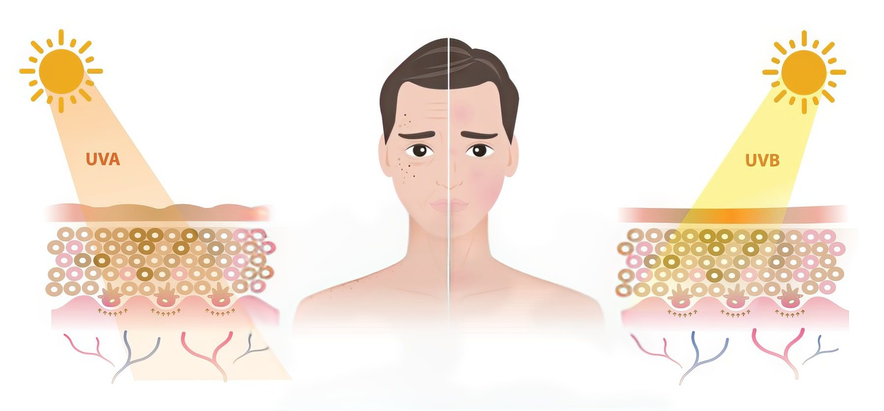 Nguyên nhân bị nám da mặt ở nam giới