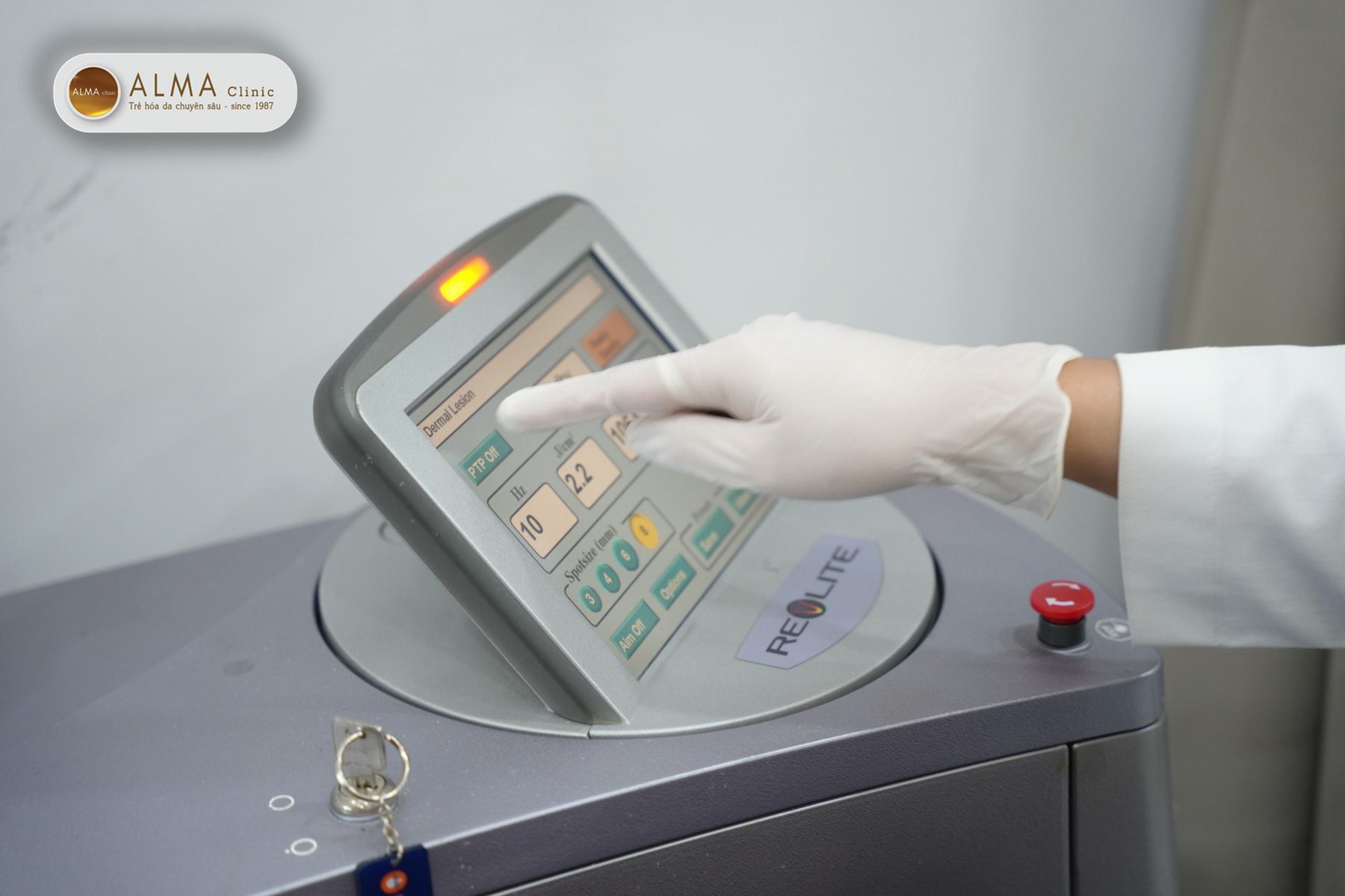 Trị nám da sau sinh có cần laser không?