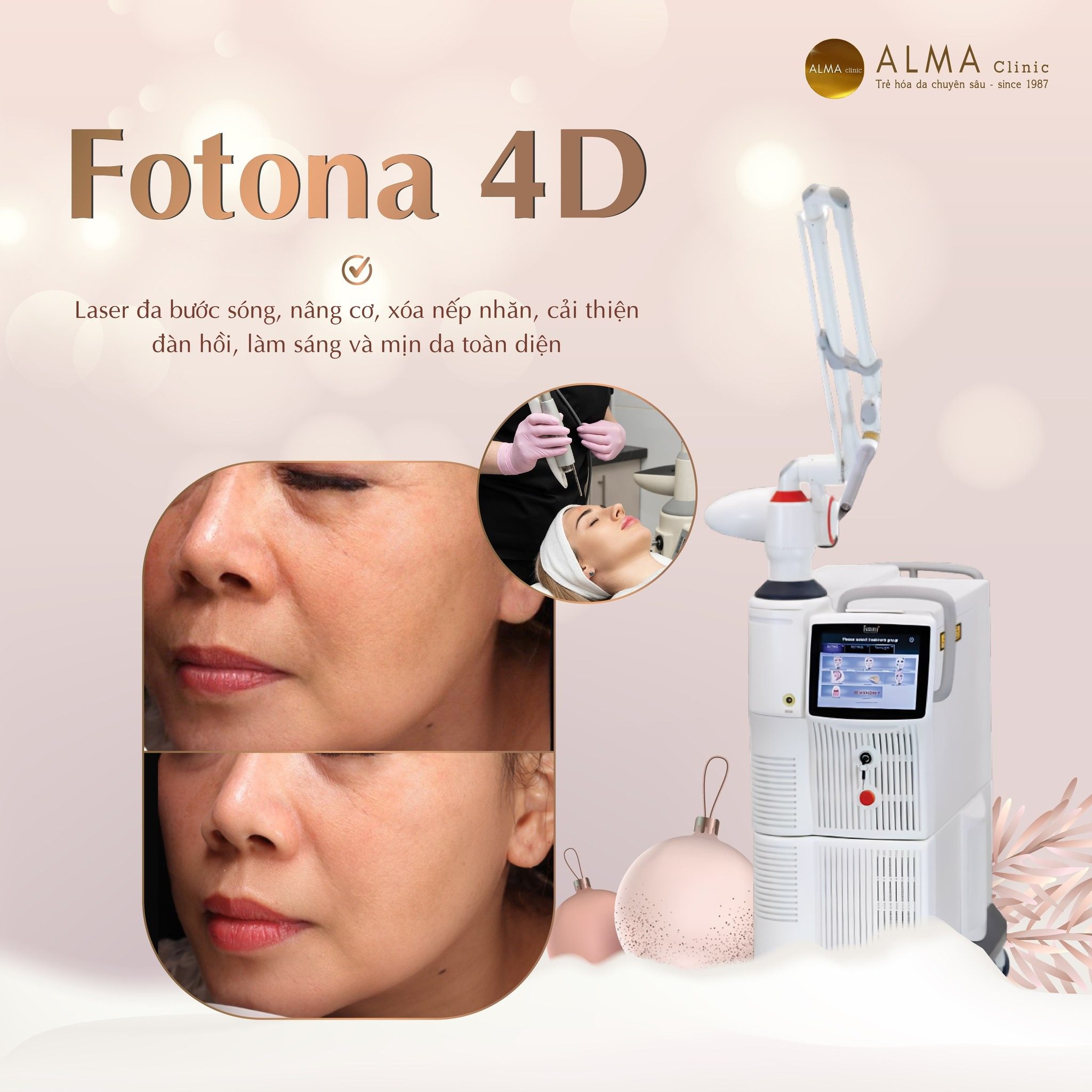 Công dụng trẻ hóa đa tầng của Fotona 4D
