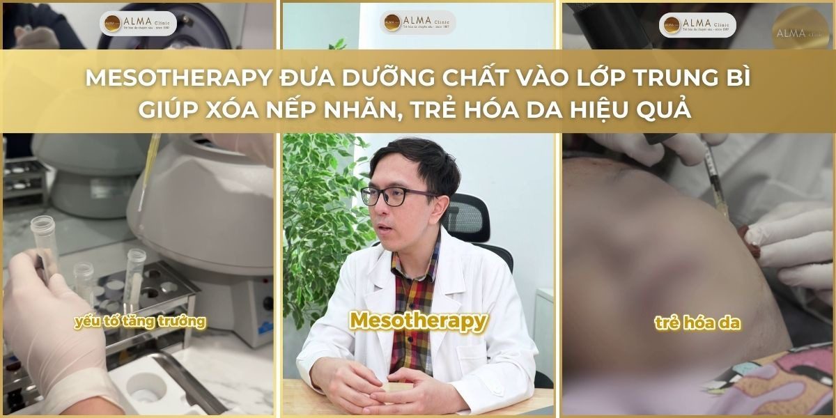 Kỹ thuật tiêm BAP tại Alma Clinic