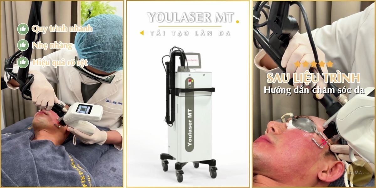 Công nghệ YouLaser MT tái tạo làn da