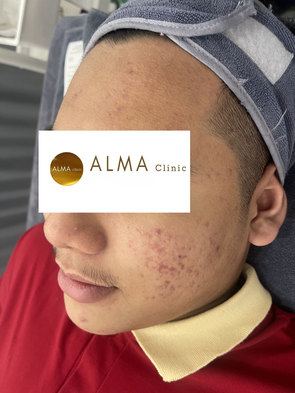 Phòng khám da liễu ALMA CLINIC CASE 03 GOC NT TEN HMT lan 3 NGAY 2511120