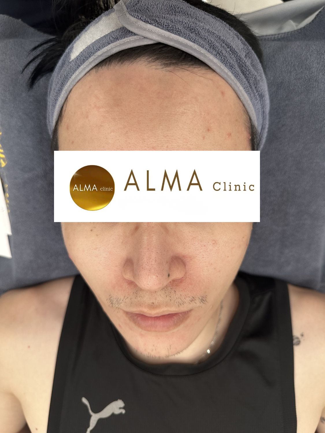 Phòng khám da liễu ALMA CLINIC CASE 04 GOC CD TEN TVC lan 2 NGAY 251104