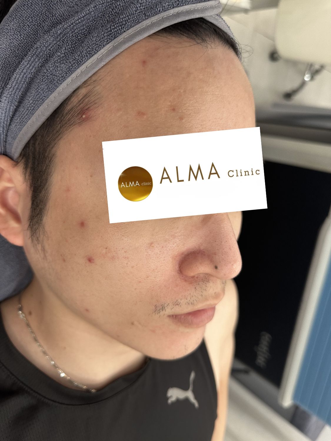 Phòng khám da liễu ALMA CLINIC CASE 04 GOC NP TEN TVC lan 2 NGAY 251104