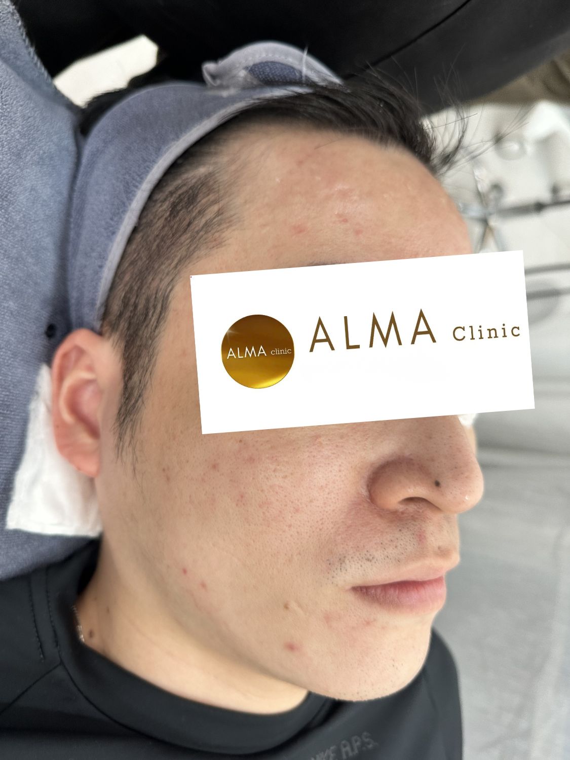 Phòng khám da liễu ALMA CLINIC CASE 04 GOC NP TEN TVC lan 3 NGAY 251205