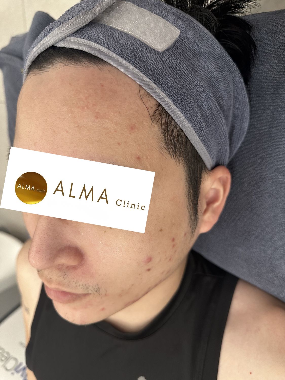 Phòng khám da liễu ALMA CLINIC CASE 04 GOC NT TEN TVC lan 2 NGAY 251104