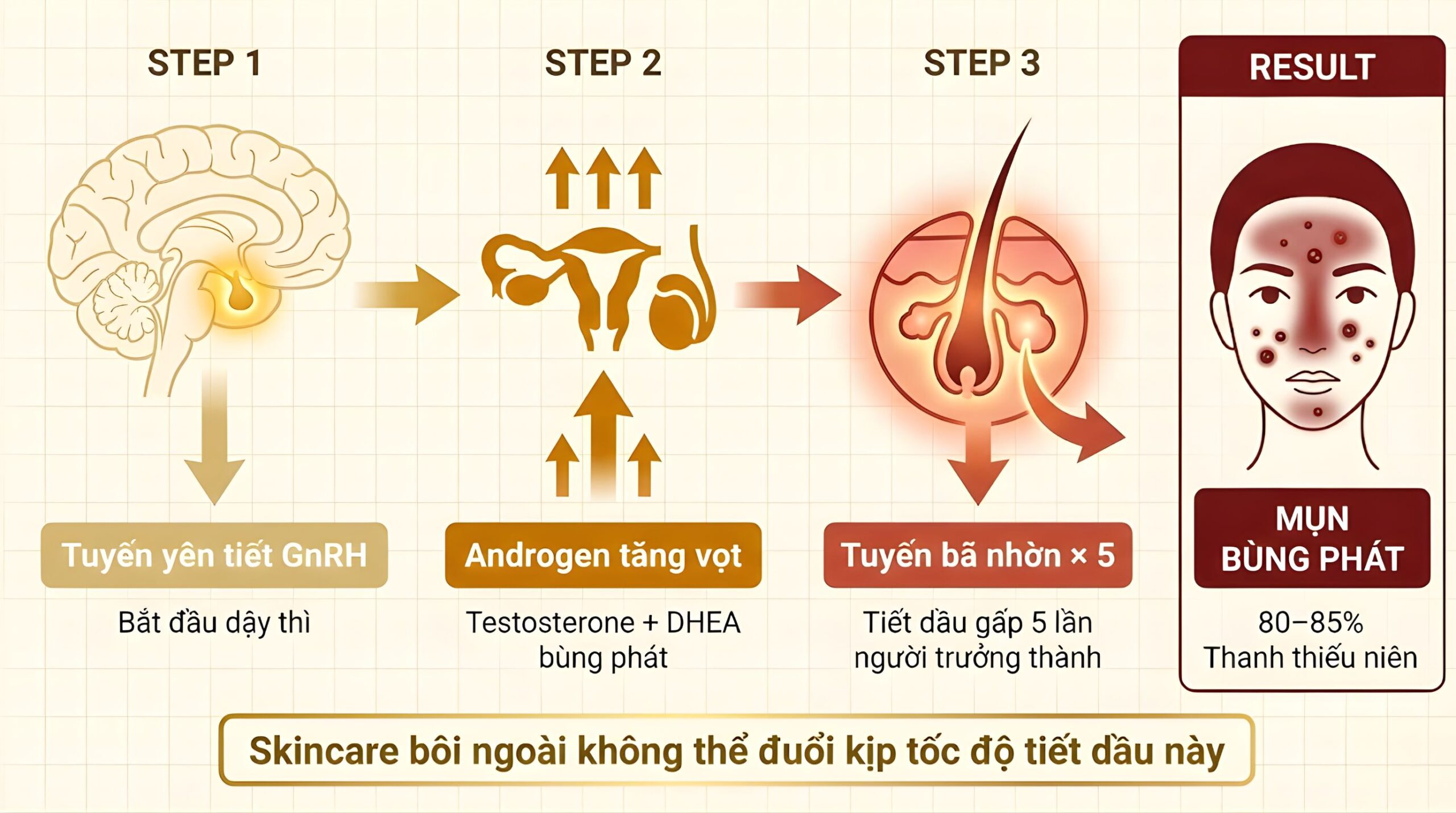 Cơ chế hormone gây mụn dậy thì: Tuyến yên tiết GnRH → Androgen tăng vọt → Tuyến bã nhờn hoạt động gấp 5 lần → Mụn bùng phát ở 80–85% thanh thiếu niên — skincare không giải quyết được nguyên nhân