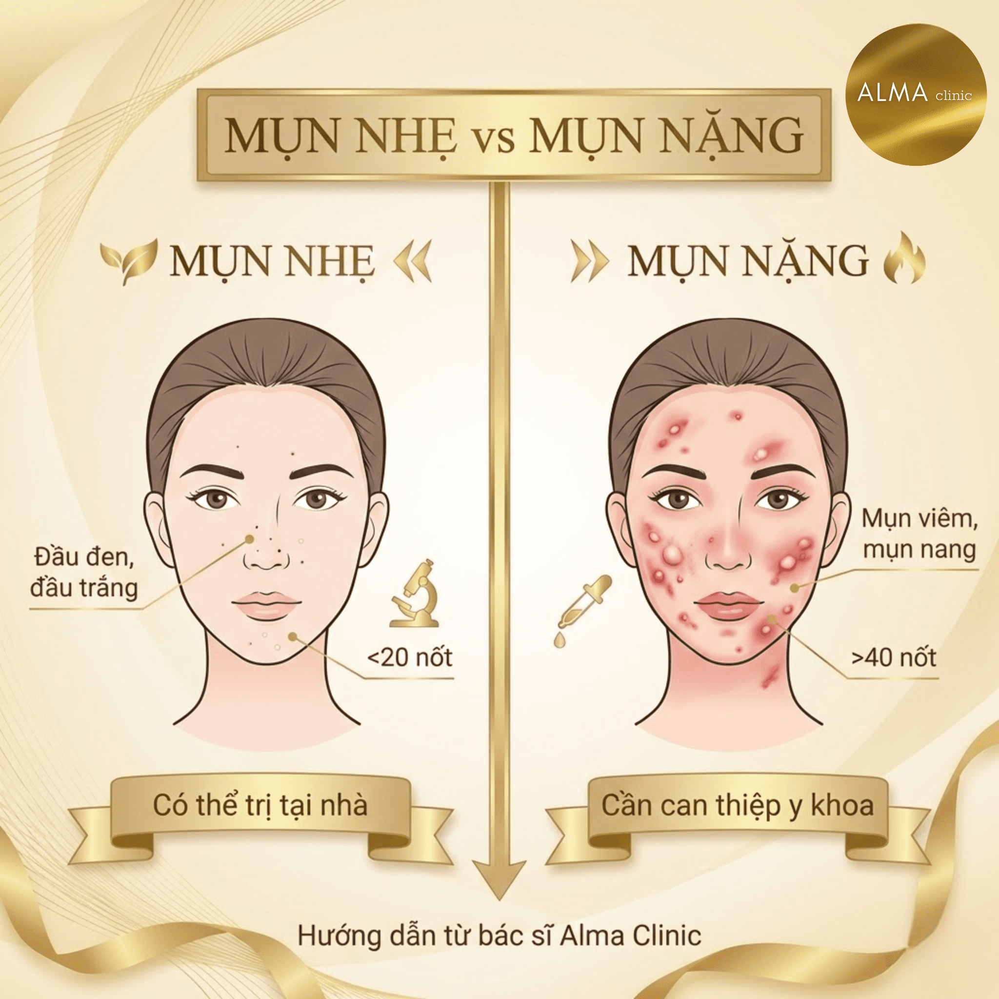 So sánh mụn nhẹ và mụn nặng - đầu đen đầu trắng vs mụn viêm mụn nang - hướng dẫn từ bác sĩ Alma Clinic