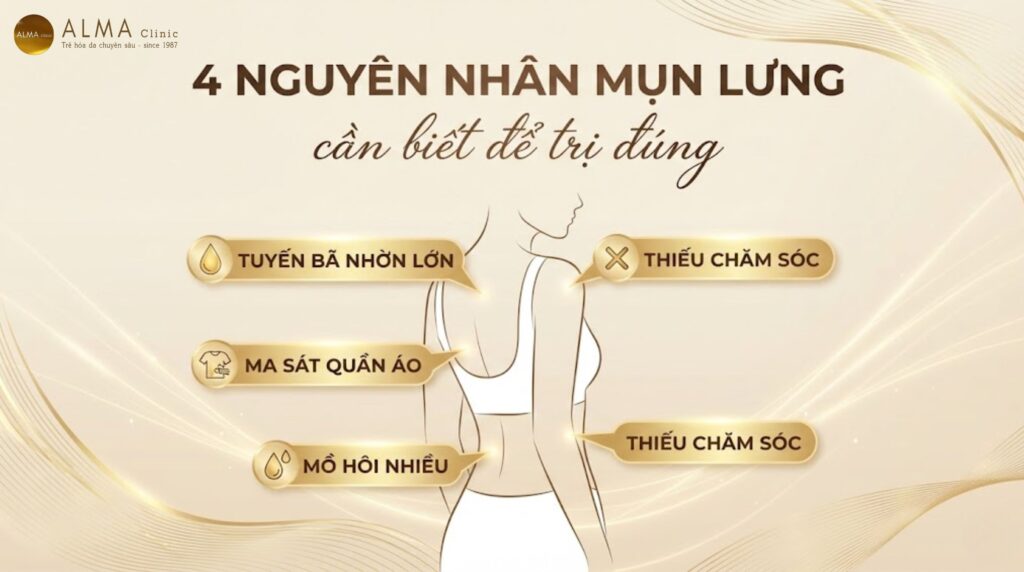 4 nguyên nhân mụn lưng - tuyến bã nhờn lớn ma sát quần áo mồ hôi nhiều thiếu chăm sóc - giải thích bác sĩ Alma Clinic