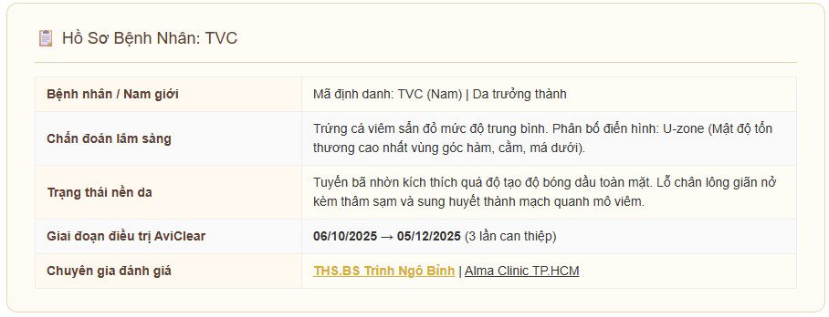 review aviclear mun noi tiet tvc 1 Nhật Ký HMT: Mụn Dậy Thì Nam — AviClear Thay Isotretinoin