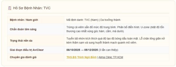 Nhật Ký TVC: Mụn Nội Tiết Viền Hàm Nam — 3 Lần AviClear