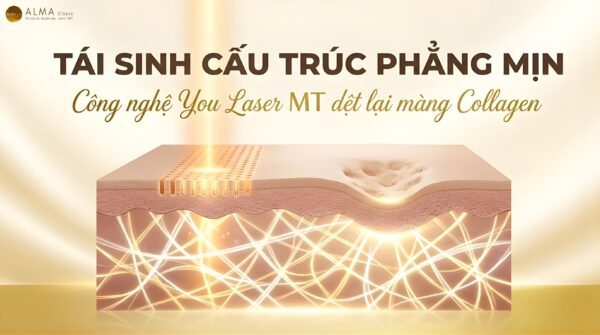 You Laser MT Giúp Cải Thiện Cấu Trúc Da Sau Mụn Như Thế Nào?