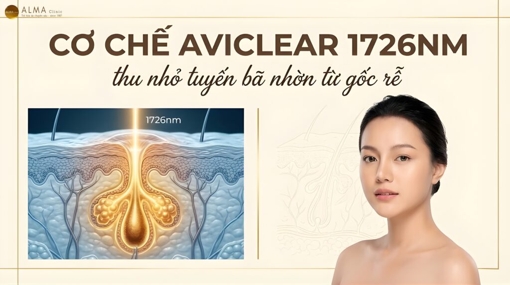 AviClear Làm Giảm Kích Thước Tuyến Bã Nhờn Theo Cơ Chế Nào? [2026]