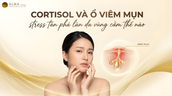Cortisol Và Mụn Vùng Cằm: Cơ Chế Viêm Do Stress