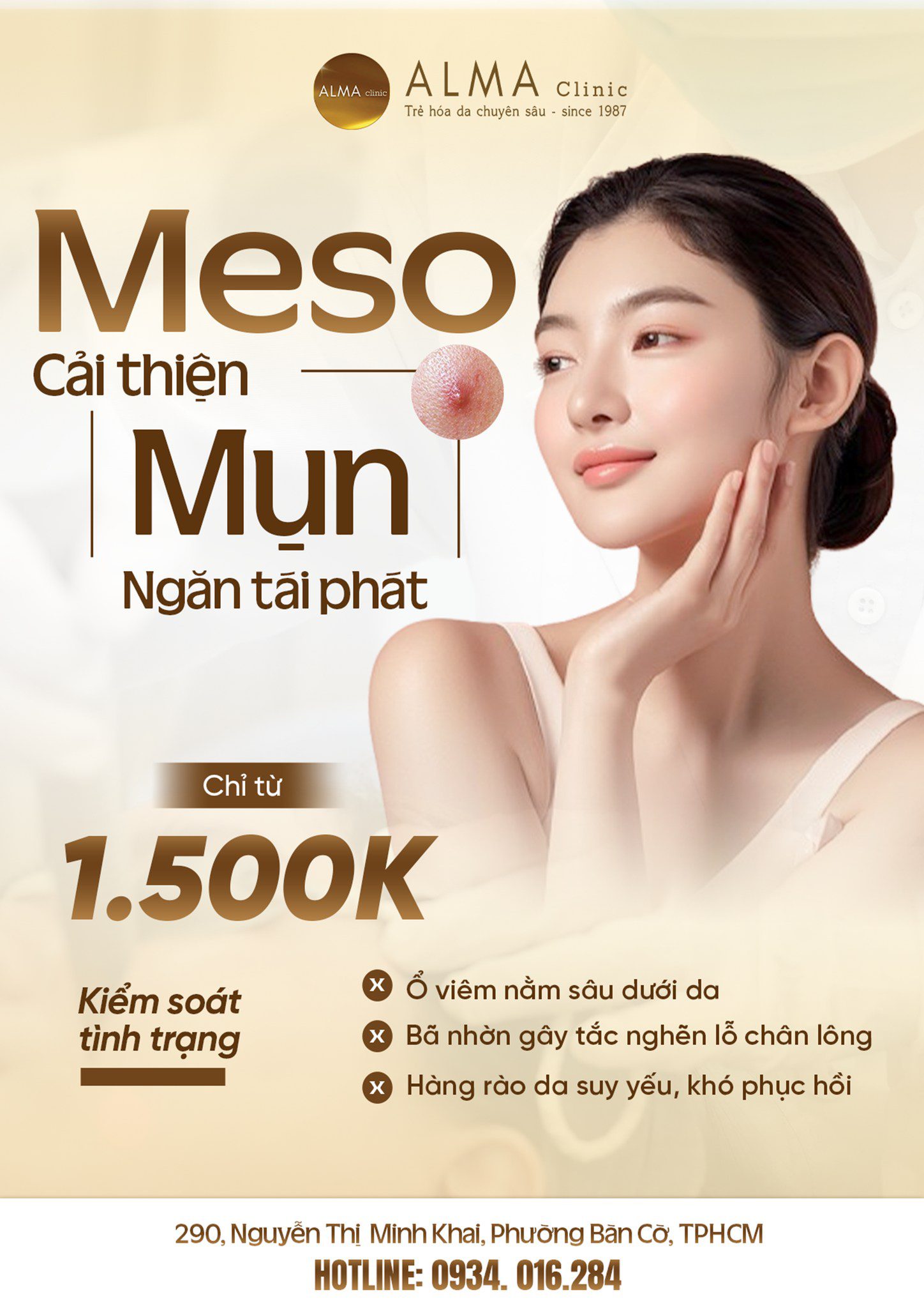 Meso cải thiện ngăn mụn tái phát tại Alma Clinic