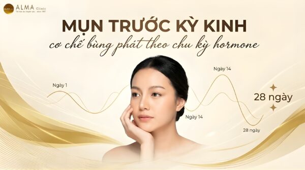 Tại Sao Mụn Bùng Phát Dữ Dội Trước Kỳ Kinh? [Bác Sĩ Giải Thích]